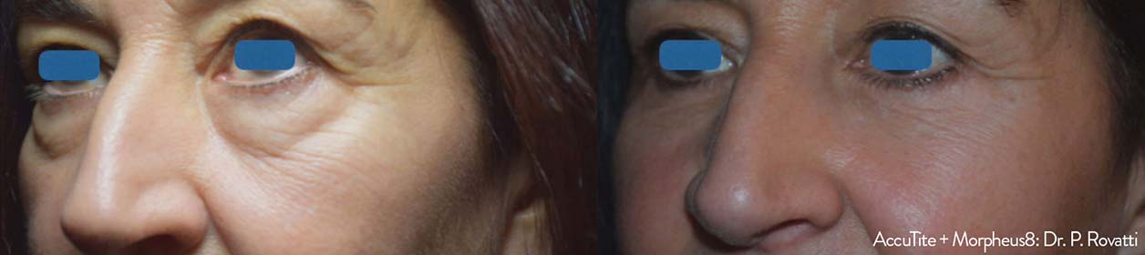 Brea Medical Aesthetics DR. P Rovatti