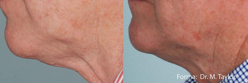 Brea Medical Aesthetics Forma Dr. M. Taylor
