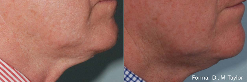 Brea Medical Aesthetics Forma Dr. M. Taylor