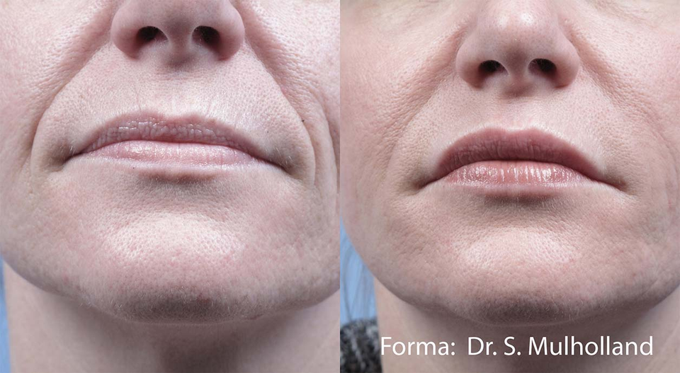 Brea Medical Aesthetics Forma Dr. S. Mulholland