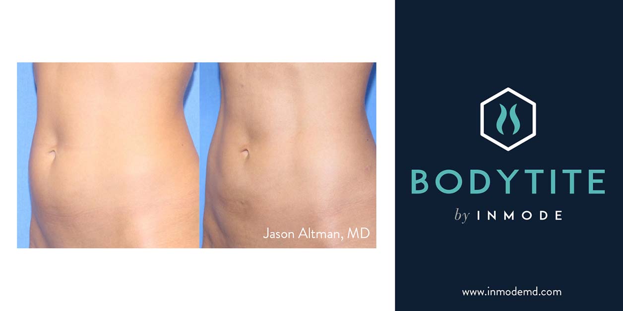 Brea Medical Aesthetics Jason Altman, MD