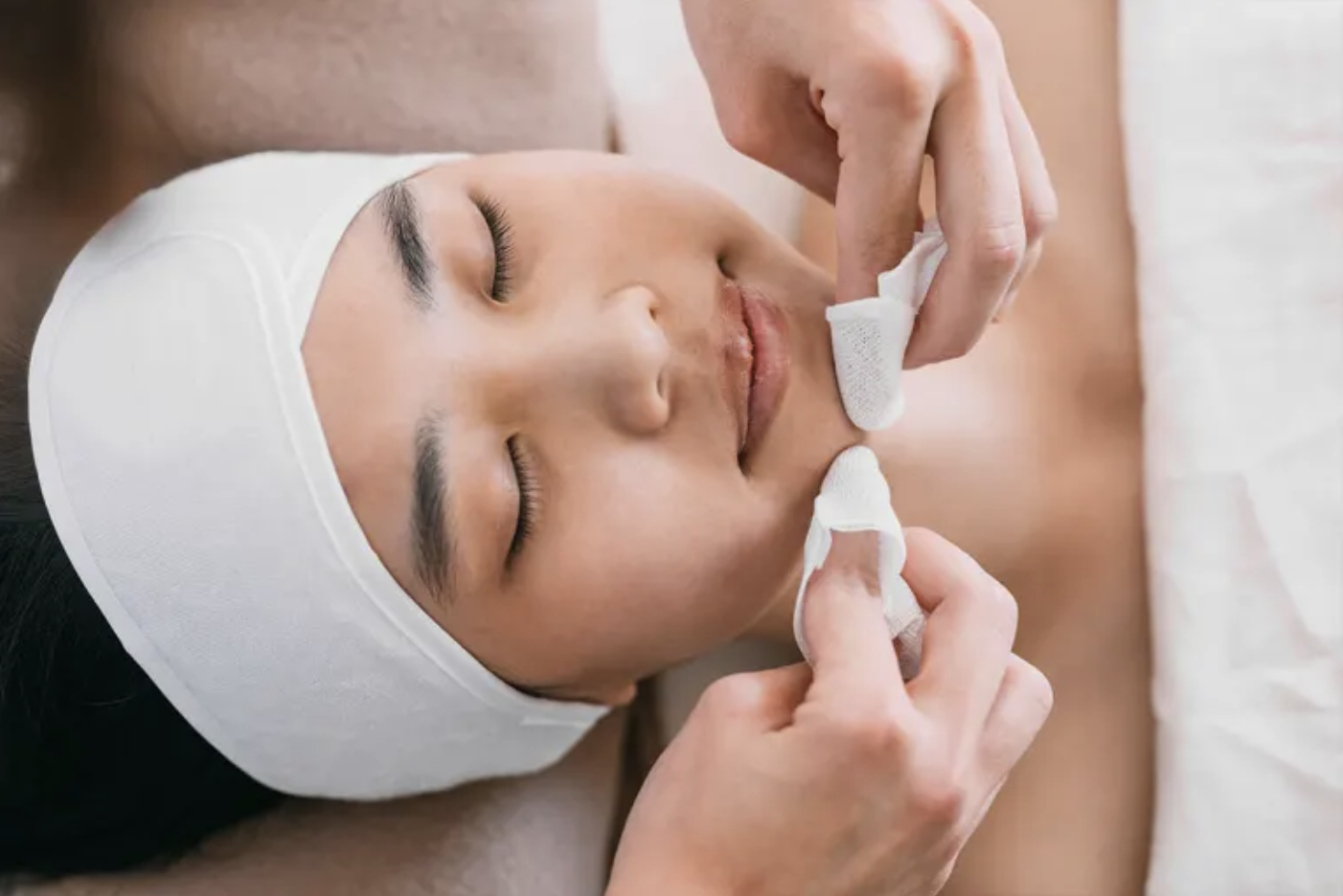 Acne Facial
