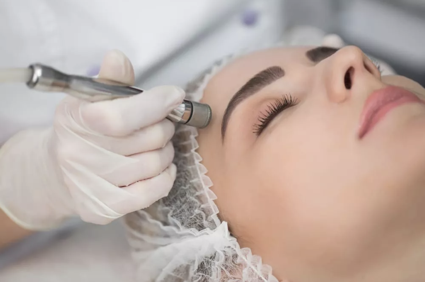 Microdermabrasion Facial